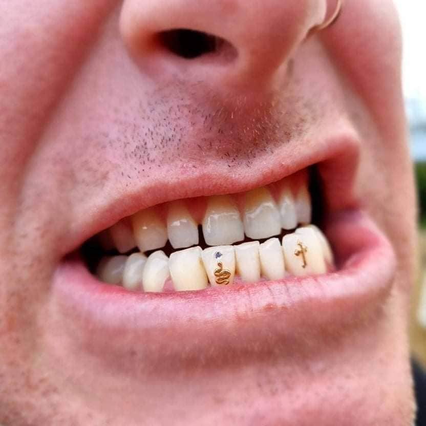 Tooth Gem Image